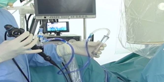 Ureteroscopy