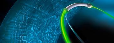 BPH: Laser surgery